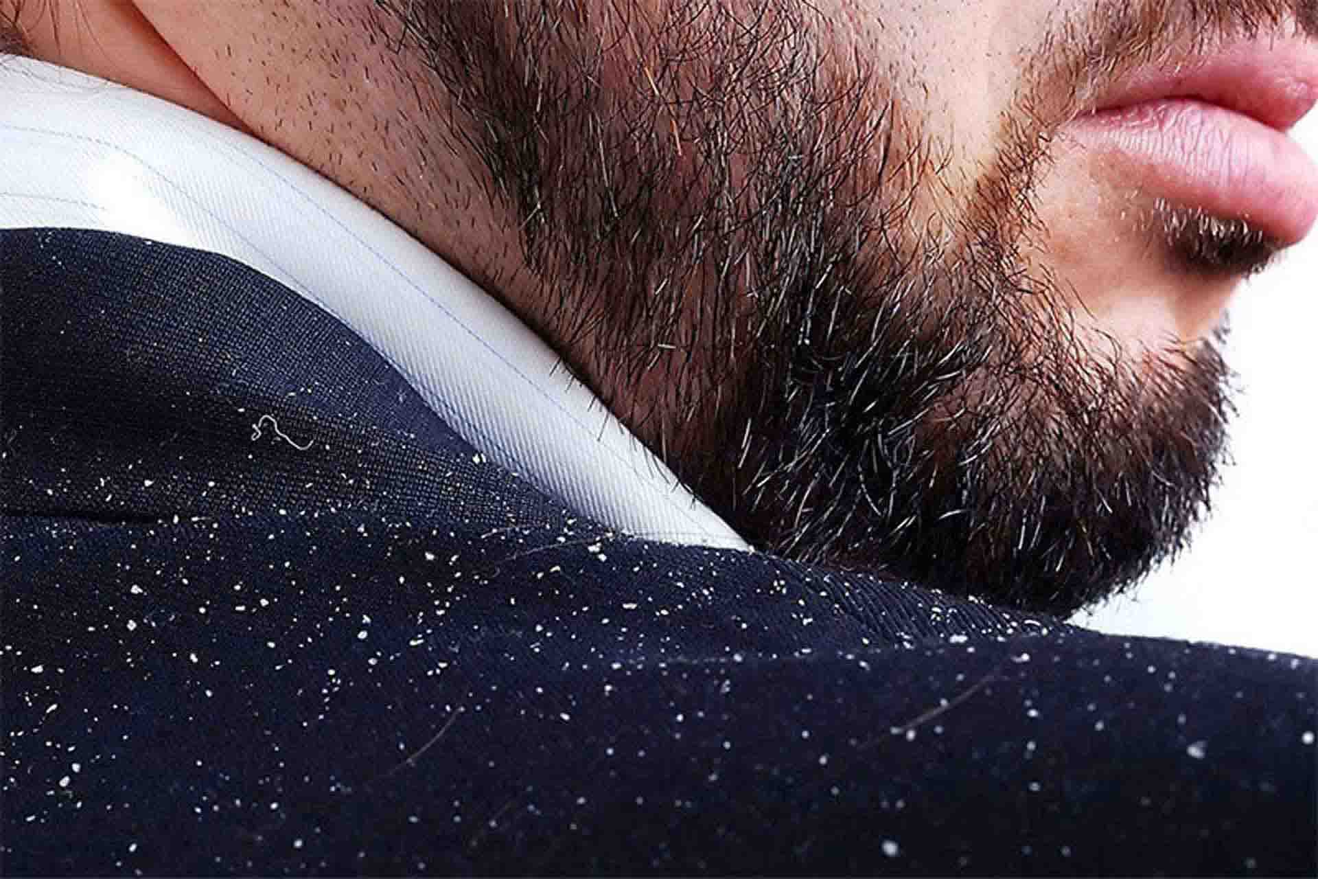 کلینیک پارس ، درمانگاه پارس ،متخصص پوست و مو ،شوره سر 