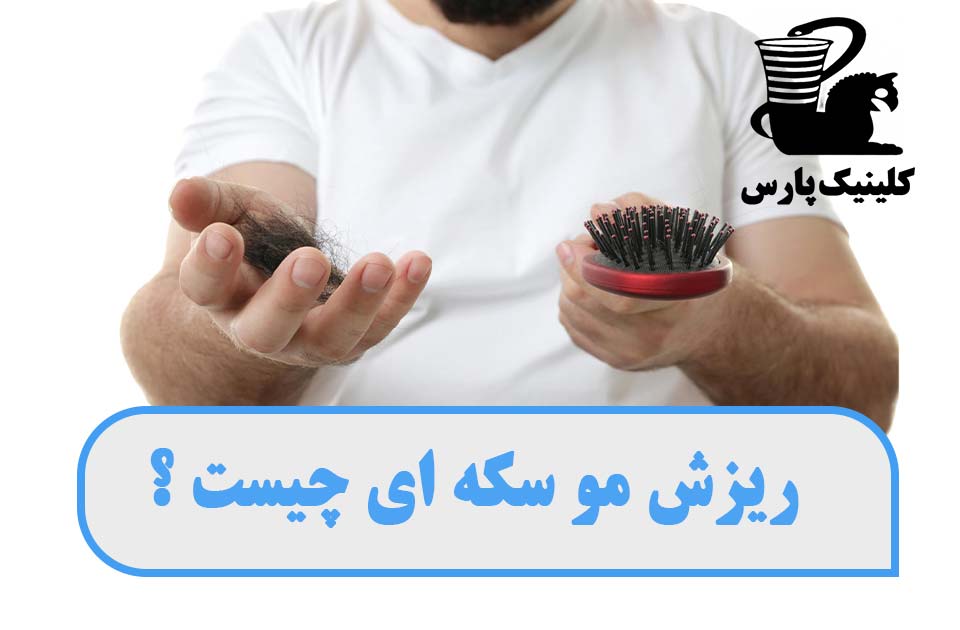 درمانگاه شبانه روزی پارس ،درمانگاه فردیس ،درمانگاه کرج ، کلینیک پارس ،درمان ریزش مو ، ریزش مو سکه ای 