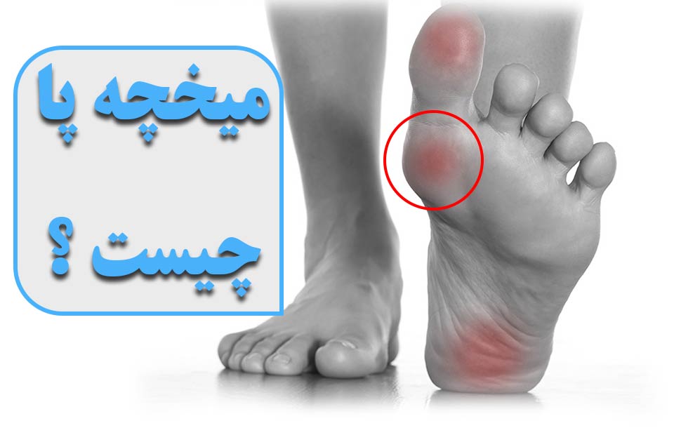 درمانگاه شبانه روزی پارس ،درمانگاه فردیس ،درمانگاه کرج ، کلینیک پارس ، ارتوپد،اطفال،جراحی،مامایی،زیبایی، جراحی در کرج، میخچه پا ، میخچه ، درمان میخچه پا  
