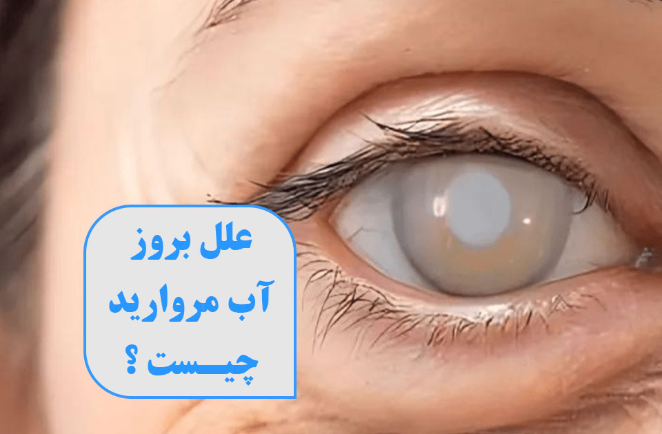 درمانگاه شبانه روزی پارس ،درمانگاه فردیس ،درمانگاه کرج ، کلینیک پارس ، ارتوپد،اطفال،جراحی،مامایی،زیبایی،آب مروارید ، علل ایجاد آب مروارید ، آب مروارید چشم 